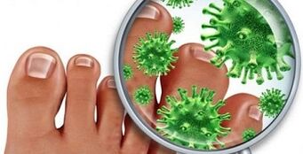 Cum să tratezi o infecție fungică pe degete