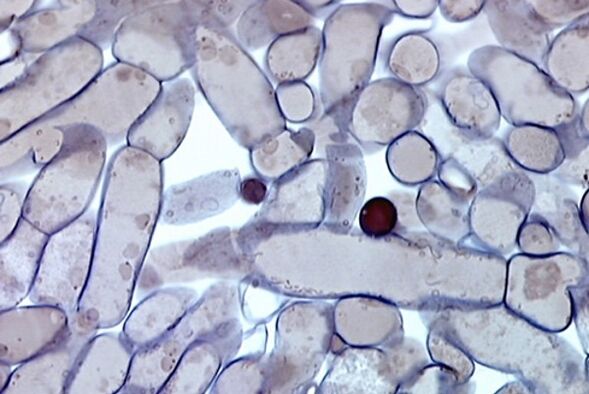 celulele ciupercii unghiilor la microscop