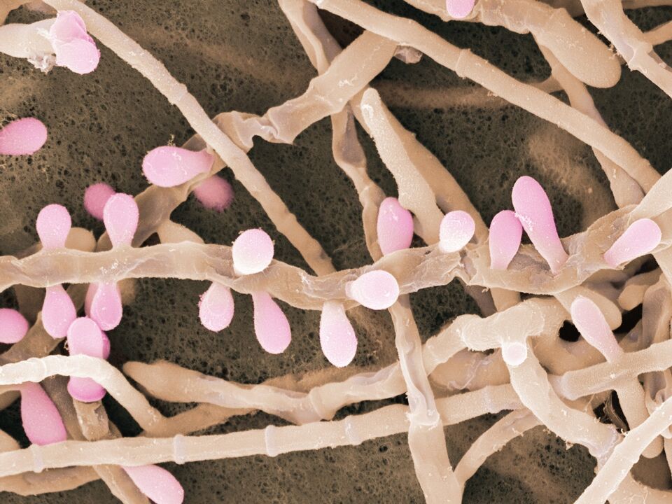 Trichophyton rubrum este un tip de ciupercă care afectează pielea picioarelor.